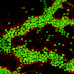 ANtibody to VEGFR2