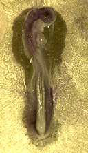 Embryo1