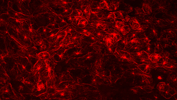 alpha Tubulin Staining